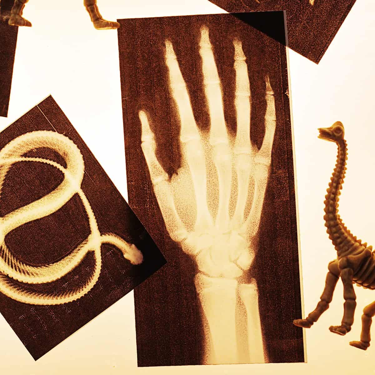 Children’s Play X-Rays that can be printed at home!