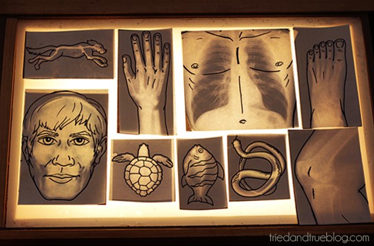 Printable X-Rays with matching line drawings on a light table.